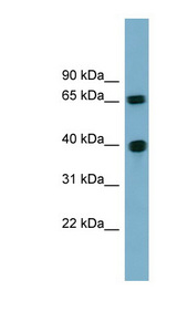 CCNJ / Cyclin J antibody LS-C112031 Western blot of 721_B cell lysate.
