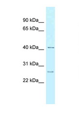CCNK antibody LS-C145879 Western blot of 8226 Cell lysate. Antibody concentration 1 ug/ml.