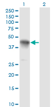 Western blot of CCNK expression in transfected 293T cell line by CCNK monoclonal antibody (M03), clone S1.