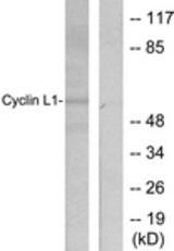 Western blot of extracts from HepG2 cells, using Cyclin L1 Antibody. The lane on the right is treated with the synthesized peptide.