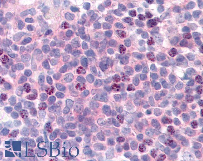 Anti-CCNL1 / Cyclin L1 antibody IHC of human thymus. Immunohistochemistry of formalin-fixed, paraffin-embedded tissue after heat-induced antigen retrieval. Antibody LS-B79 concentration 20 ug/ml.