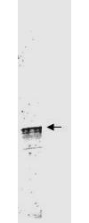 Western blot of Protein A Purified anti-Cyclin L1a antibody shows detection of a band ~59 kDa corresponding to a Cyclin L1a (arrowhead) present in mouse brain whole cell lysate. Approximately 35g of lysate was separated by 4-20% SDS-PAGE followed by transfer to nitrocellulose. After blocking the membrane was probed with the primary antibody diluted to 1:3,500 for 2h at room temperature followed by washes and reaction with a 1:10000 dilution of IRDye800 conjugated Gt-a-Rabbit IgG [H&L] MX (611-132-122) for 45 min at room temperature. IRDye800 fluorescence image was captured using the Odyssey Infrared Imaging System developed by LI-COR. IRDye is a trademark of LI-COR, Inc. Other detection systems will yield similar results.