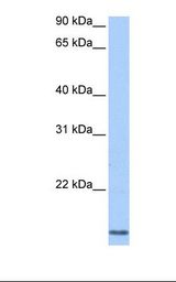 Jurkat cell lysate. Antibody concentration: 0.5 ug/ml. Gel concentration: 12%.