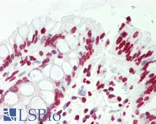 Anti-CCNL2 / Cyclin L2 antibody IHC staining of human colon. Immunohistochemistry of formalin-fixed, paraffin-embedded tissue after heat-induced antigen retrieval. Antibody LS-B10676 dilution 1:75.
