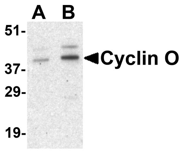 Western blot analysis of Cyclin O in human bladder tissue lysate with Cyclin O antibody at (A) 1 and (B) 2 ug/ml.