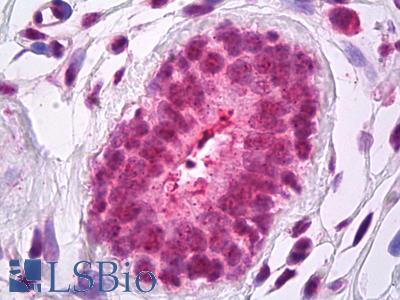 Anti-CCNO / Cyclin O antibody IHC of human breast. Immunohistochemistry of formalin-fixed, paraffin-embedded tissue after heat-induced antigen retrieval. Antibody LS-B7280 concentration 5 ug/ml.