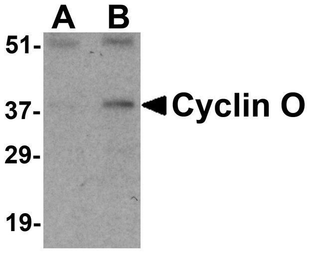 Western blot analysis of Cyclin O in mouse bladder tissue lysate with Cyclin O antibody at (A) 1 and (B) 2 ug/ml.