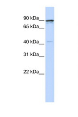 CCNT1 / Cyclin T1 antibody LS-C102825 Western blot of 721_B Cell lysate. Antibody concentration 1 ug/ml.