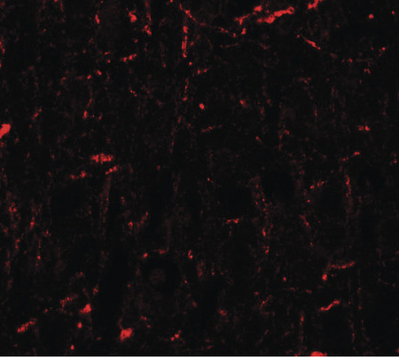 Immunofluorescence of CCNT1 in rat brain tissue with CCNT1 antibody at 20 ug/ml.