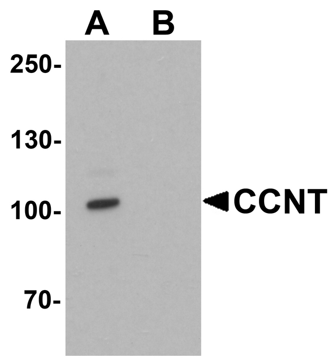Western blot analysis of CCNT1 in rat brain tissue lysate with CCNT1 antibody at 1 ug/ml in (A) the absence and (B) the presence of blocking peptide.
