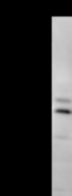 Detection of human CCNT2 by Western blot. Samples: Whole cell lysate (50 ug) from HeLa cells. Predicted molecular weight: 81 kDa