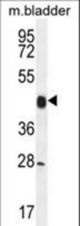 CCNY Antibody western blot of mouse bladder tissue lysates (35 ug/lane). The CCNY antibody detected the CCNY protein (arrow).