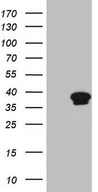 HEK293T cells were transfected with the pCMV6-ENTRY control (Left lane) or pCMV6-ENTRY CCNY (Right lane) cDNA for 48 hrs and lysed. Equivalent amounts of cell lysates (5 ug per lane) were separated by SDS-PAGE and immunoblotted with anti-CCNY (1:2000).