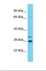Western blot of Human Jurkat. CCNYL1 antibody dilution 1.0 ug/ml.