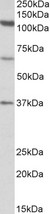 CCP110 antibody (1 ug/ml) staining of Human Testis lysate (35 ug protein in RIPA buffer). Primary incubation was 1 hour. Detected by chemiluminescence.