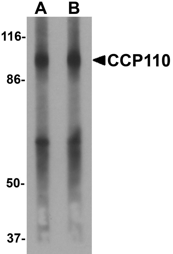 Western blot analysis of CCP110 in human colon tissue lysate with CCP110 antibody at (A) 1 and (B) 2 ug/ml.