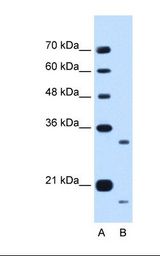 Lane A: Marker. Lane B: HepG2 cell lysate. Antibody concentration: 0.25 ug/ml. Gel concentration: 12%.