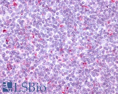 Anti-CCR10 antibody LS-A1155 IHC of human tonsil. Immunohistochemistry of formalin-fixed, paraffin-embedded tissue after heat-induced antigen retrieval.