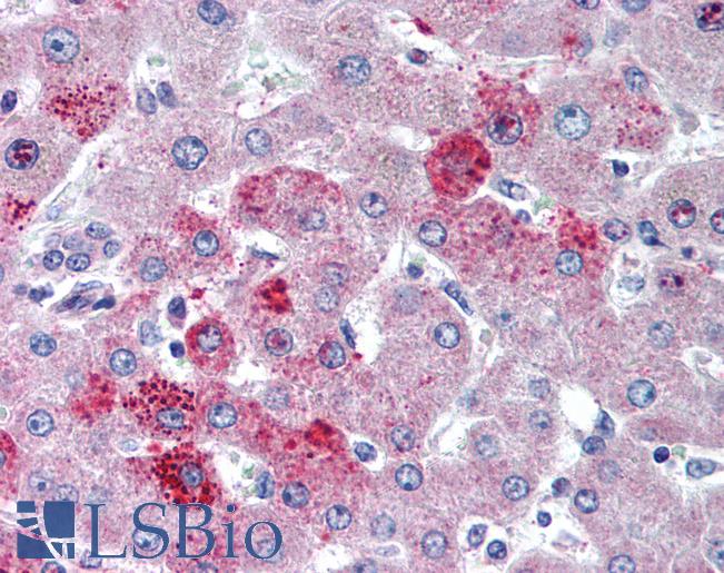 Anti-CCR10 antibody IHC of human liver. Immunohistochemistry of formalin-fixed, paraffin-embedded tissue after heat-induced antigen retrieval. Antibody LS-B2023 concentration 5 ug/ml.