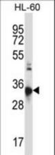 CCR10 Antibody western blot of HL-60 cell line lysates (35 ug/lane). The CCR10 antibody detected the CCR10 protein (arrow).