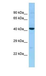 CCR10 / GPR2 antibody Western Blot of Fetal Liver. Antibody dilution: 1 ug/ml.