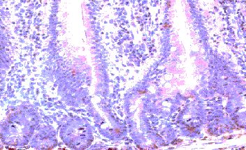 Immunohistochemistry of paraffin-embedded mouse small intestine with Goat anti-mouse CCR10