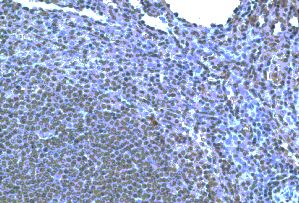 Immunohistochemistry of paraffin-embeddedi human spleen stained with Goat anti-Human CCR10