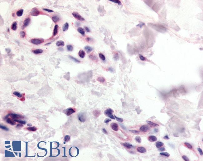 Anti-CCR10 antibody LS-A1153 IHC of human skin, capillaries. Immunohistochemistry of formalin-fixed, paraffin-embedded tissue after heat-induced antigen retrieval.