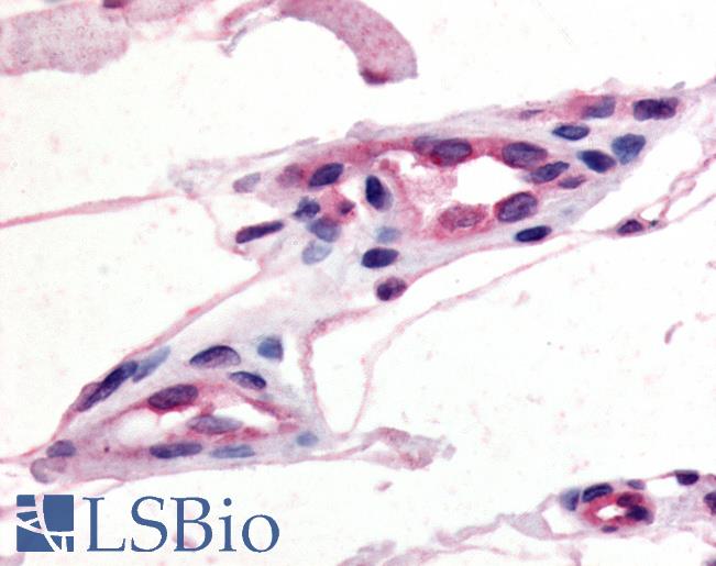Anti-CCR10 antibody LS-A1154 IHC of human capillaries. Immunohistochemistry of formalin-fixed, paraffin-embedded tissue after heat-induced antigen retrieval.