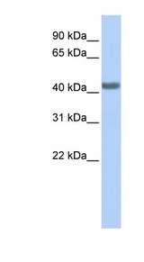 CCR2 antibody LS-C112191 Western blot of 721_B cell lysate.