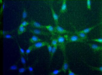 CCR2 Antibody - Immunocytochemical analysis of CCR2 in NIH/3T3 cells.