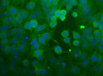 CCR2 Antibody - Immunocytochemical analysis of CCR2 in HeLa cells.
