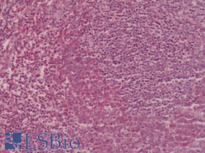 Human Tonsil: Formalin-Fixed, Paraffin-Embedded (FFPE)