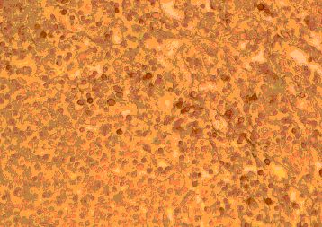 Immunohistochemistry of paraffin-embeddedi human spleen stained with Goat anti-Human CD192 (N-Terminal)