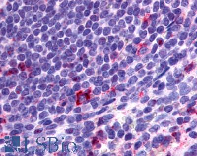Anti-CCR2 antibody LS-A1899 IHC of human spleen, lymphocytes. Immunohistochemistry of formalin-fixed, paraffin-embedded tissue after heat-induced antigen retrieval.
