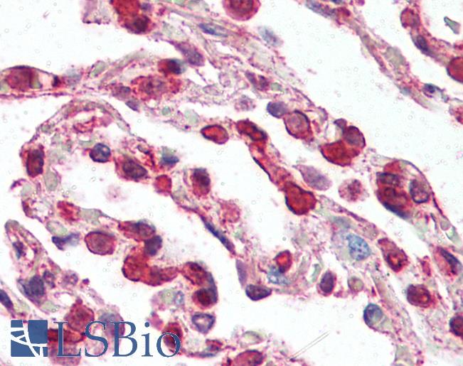 Anti-CCR3 antibody IHC of human lung. Immunohistochemistry of formalin-fixed, paraffin-embedded tissue after heat-induced antigen retrieval. Antibody LS-B3185 concentration 5 ug/ml.