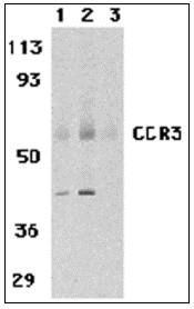Western blot of CCR3 in human spleen tissue lysates with CCR3 antibody at 1 (lane 1) and 2 ug/ml (lane 2), and 2 ug/ml in the presence of blocking peptide (lane 3).