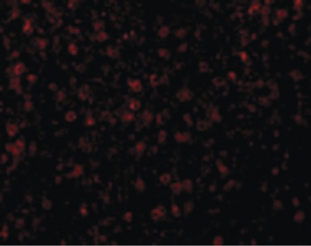 Immunofluorescence of CCR3 in Human Spleen cells with CCR3 antibody at 20 ug/ml.