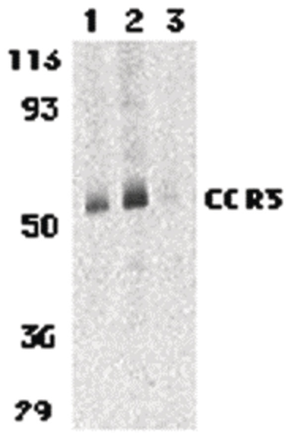 Western blot of CCR3 in human spleen tissue lysates with CCR3 antibody at 1 (lane 1) and 2 ug/ml (lane 2), and 2 ug/ml in the presence of blocking peptide (lane 3).