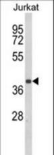 Western blot of CCR3 Antibody in Jurkat cell line lysates (35 ug/lane). CCR3 (arrow) was detected using the purified antibody.