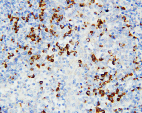 CCR4 antibody. IHC(P): Human Tonsil Tissue.