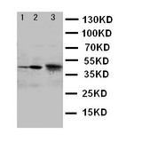 WB of CCR4 antibody. Lane 1: CEM Cell Lysate. Lane 2: JURKAT Cell Lysate. Lane 3: HELA Cell Lysate.
