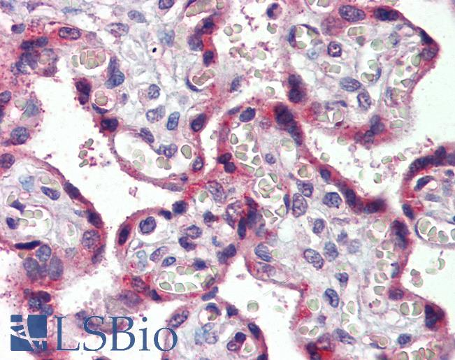 Anti-CCR4 antibody IHC of human placenta. Immunohistochemistry of formalin-fixed, paraffin-embedded tissue after heat-induced antigen retrieval. Antibody LS-B4033 concentration 5 ug/ml.
