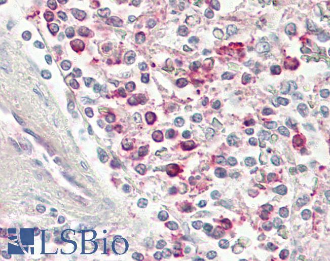 Anti-CCR4 antibody IHC of human spleen. Immunohistochemistry of formalin-fixed, paraffin-embedded tissue after heat-induced antigen retrieval.