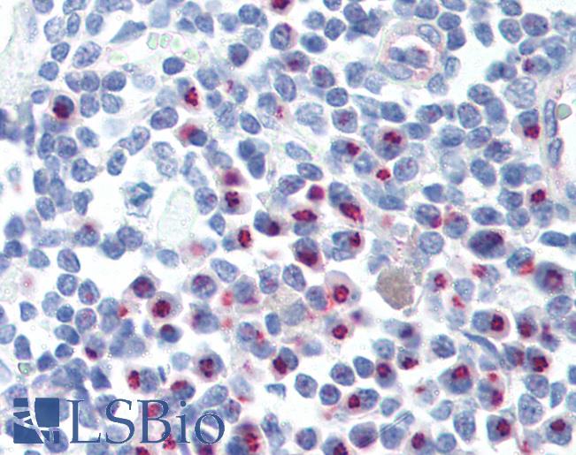 Anti-CCR4 antibody LS-A348 IHC of human lymph node. Immunohistochemistry of formalin-fixed, paraffin-embedded tissue after heat-induced antigen retrieval.