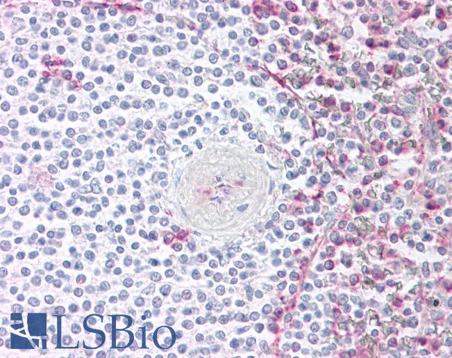 Anti-CCR4 antibody IHC of human spleen. Immunohistochemistry of formalin-fixed, paraffin-embedded tissue after heat-induced antigen retrieval.