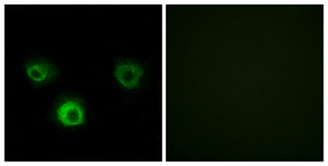 Immunofluorescence of HUVEC cells, using CCR4 Antibody. The picture on the right is treated with the synthesized peptide.