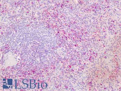 Human Spleen: Formalin-Fixed, Paraffin-Embedded (FFPE)