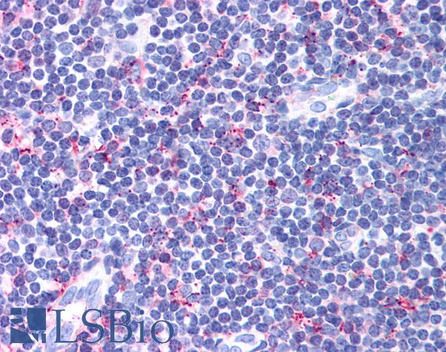Anti-CCR4 antibody LS-A491 IHC of human tonsil. Immunohistochemistry of formalin-fixed, paraffin-embedded tissue after heat-induced antigen retrieval.