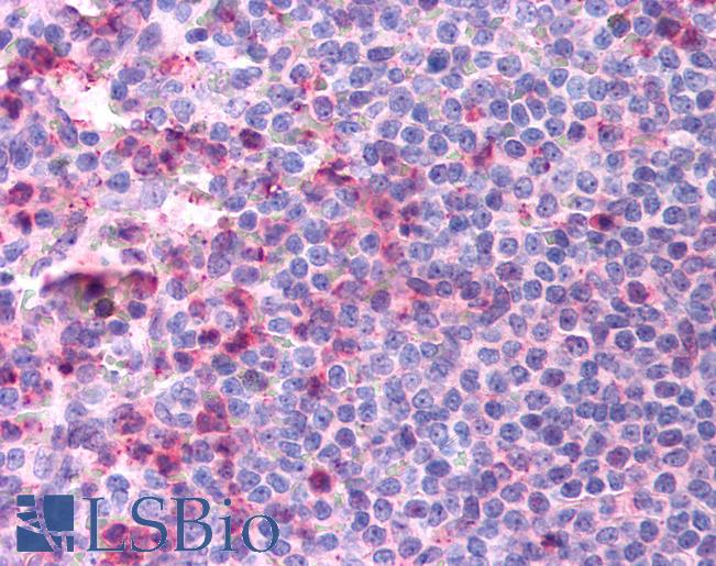 Anti-CCR4 antibody LS-A4427 IHC of human spleen. Immunohistochemistry of formalin-fixed, paraffin-embedded tissue after heat-induced antigen retrieval.
